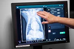 Eine Hand zeigt auf ein Röntgenbild.