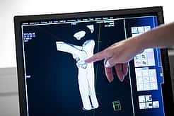 Eine Hand zeigt auf ein Röntgenbild, auf dem ein Gelenk zu sehen ist.