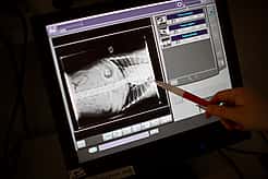 Ein Röntgenbild wird auf einem Monitor angezeigt und untersucht.