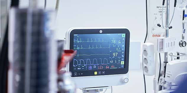 Ein Monitor zeichnet den Herzrhythmus auf.